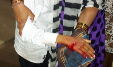 ಬೀದಿ ನಾಯಿ  ಕಚ್ಚಿ ಹಲವರಿಗೆ ಗಾಯ,  ಹೆಚ್ಚಿದ ಆತಂಕ ಆರೋಗ್ಯಾಧಿಕಾರಿ ವಿರುದ್ಧ ಸ್ಥಾಯಿ ಸಮಿತಿ ಅಧ್ಯಕ್ಷ ಸೈಯದ್ ನಯಾಜ್ ಗರಂ